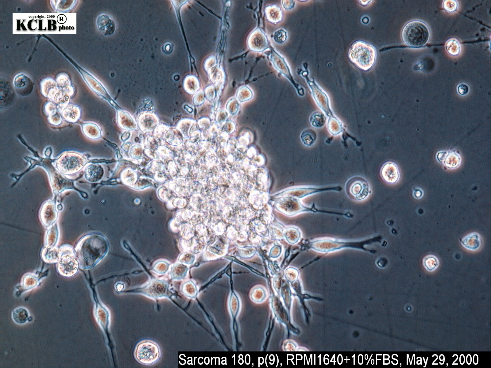 Sarcoma 180细胞图片
